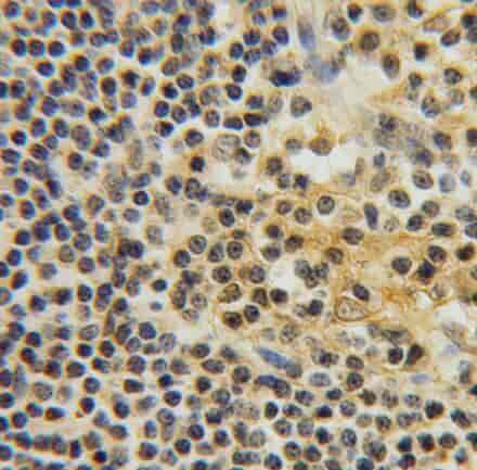 Anti-ITM2A antibody - Click Image to Close