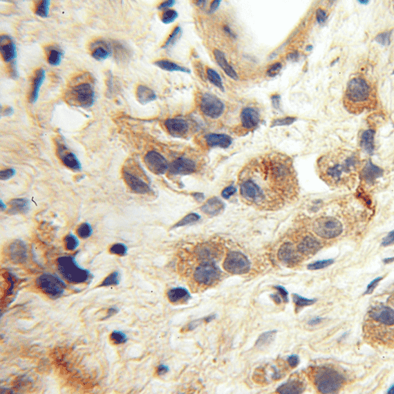 Anti-KGA/GAC antibody - Click Image to Close