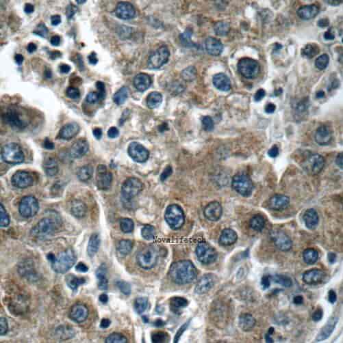 Anti-KIAA0125 antibody - Click Image to Close