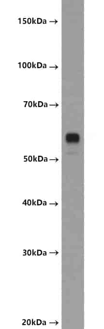 Anti-LRRTM2 antibody - Click Image to Close