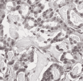 Anti-Lamin B1 antibody - Click Image to Close