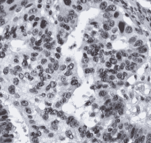 Anti-MLH1 antibody - Click Image to Close