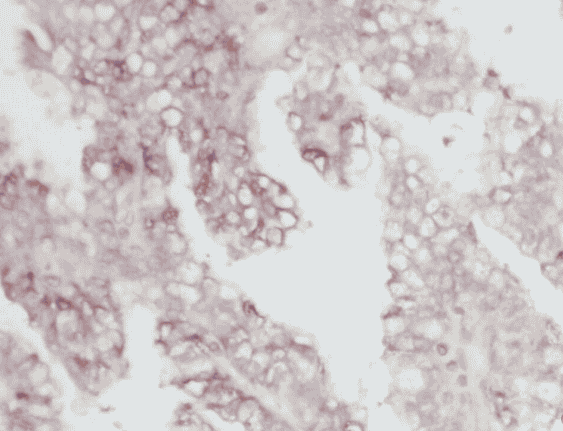 Anti-MME,CD10 antibody - Click Image to Close
