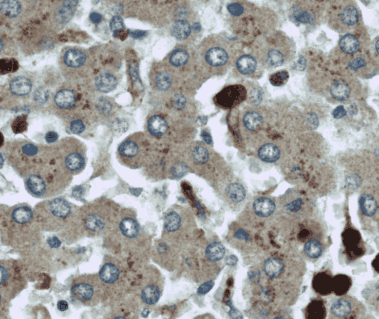 Anti-MPO antibody - Click Image to Close