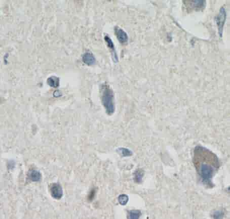 Anti-MRAP2 antibody - Click Image to Close