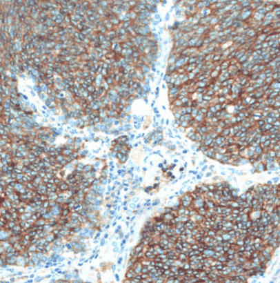 Anti-NCAM1/CD56 antibody - Click Image to Close