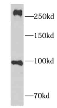 Anti-NOTCH3 antibody