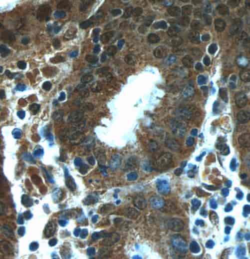 Anti-NUP205 antibody - Click Image to Close