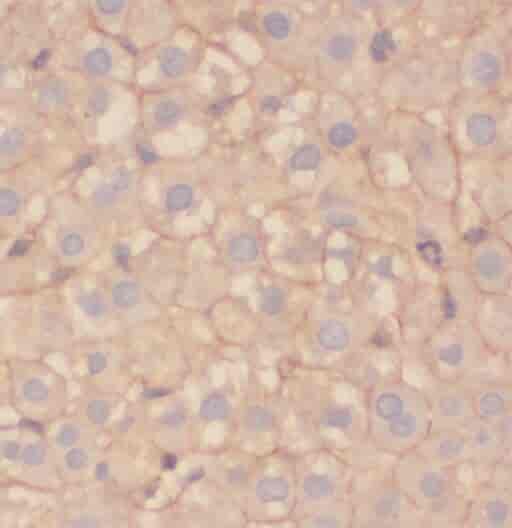 Anti-ORM1/2 antibody - Click Image to Close