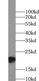 Anti-P21 antibody - Click Image to Close