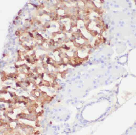 Anti-PCMT1 antibody - Click Image to Close