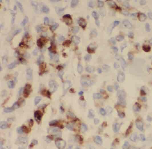 Anti-PCNA antibody - Click Image to Close