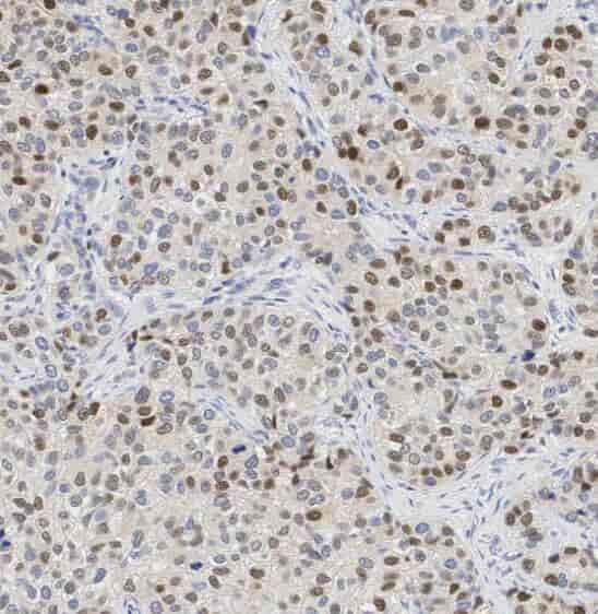 Anti-PDCD4 antibody - Click Image to Close