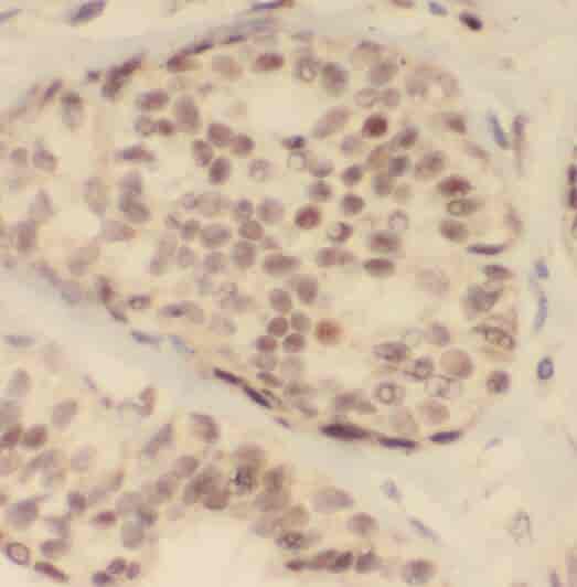 Anti-PDCD4 antibody - Click Image to Close