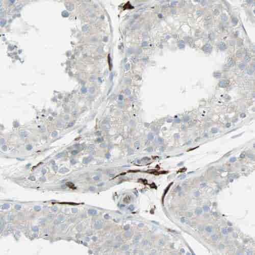 Anti-PGM1 antibody - Click Image to Close