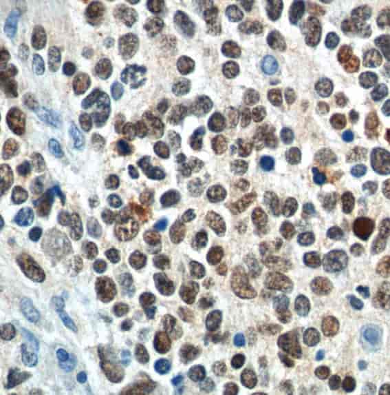 Anti-PHOX2B antibody - Click Image to Close