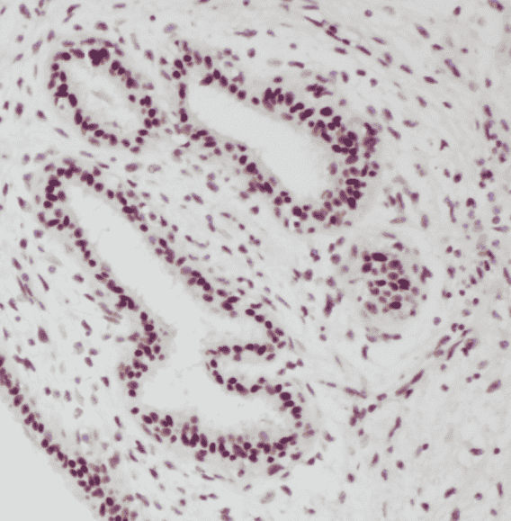 Anti-PR antibody - Click Image to Close