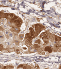 Anti-Prealbumin/transthyretin antibody - Click Image to Close