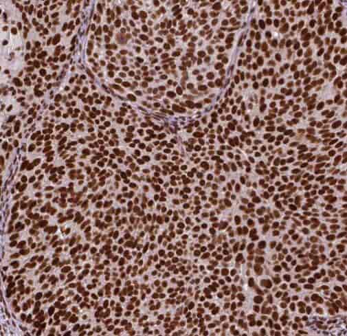 Anti-RBAP48 antibody - Click Image to Close