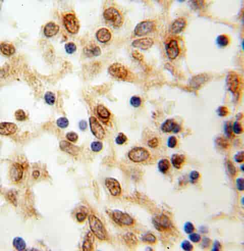 Anti-RBM15 antibody - Click Image to Close