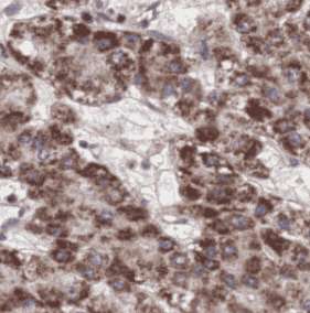 Anti-RBP4 antibody - Click Image to Close