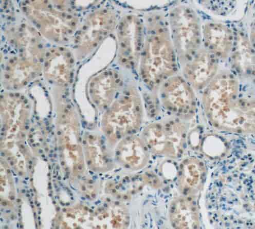 Anti-RECQL4 antibody - Click Image to Close