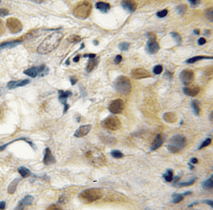 Anti-RECQL5 antibody - Click Image to Close