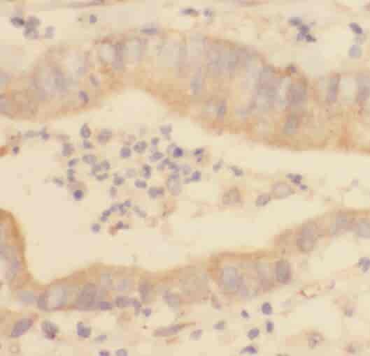 Anti-REEP5 antibody - Click Image to Close