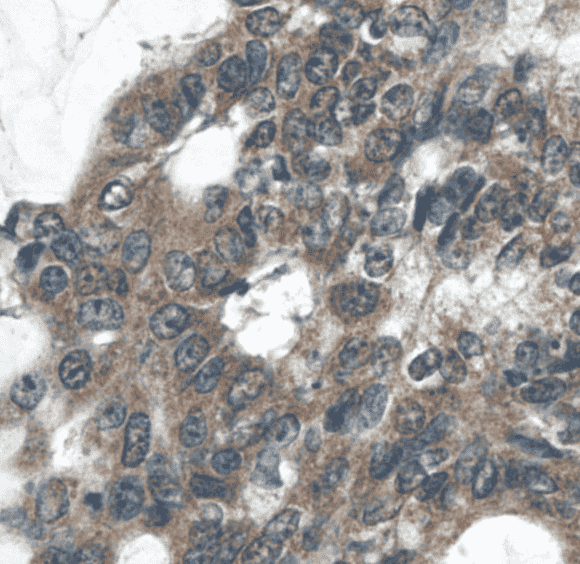 Anti-RELB antibody - Click Image to Close
