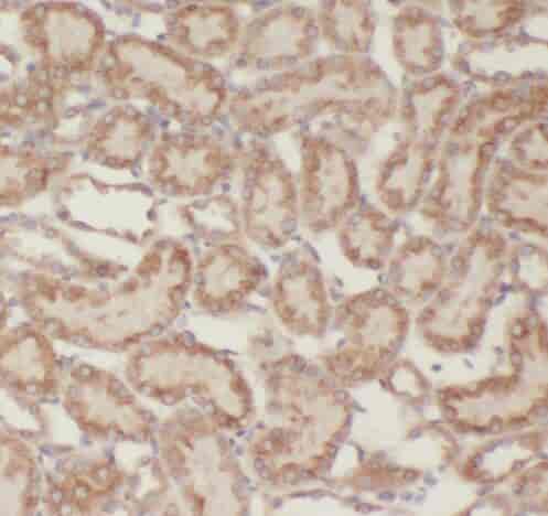 Anti-RENALASE antibody