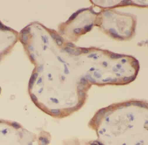 Anti-REXO2 antibody - Click Image to Close