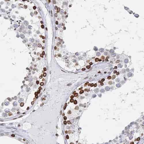 Anti-RFWD3 antibody - Click Image to Close