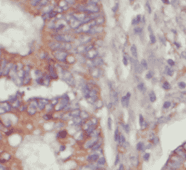 Anti-Rac1 antibody - Click Image to Close