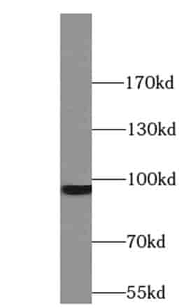 Anti-STT3B antibody - Click Image to Close