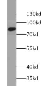 Anti-VAP1 antibody - Click Image to Close