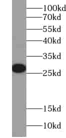 Anti-VAPB antibody - Click Image to Close