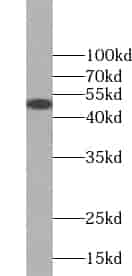 Anti-VASP antibody - Click Image to Close