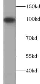 Anti-VAV2 antibody - Click Image to Close