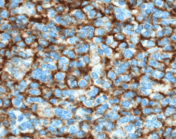 Anti-VCAM-1 antibody - Click Image to Close