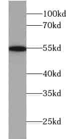 Anti-VCPIP1 antibody - Click Image to Close