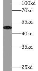Anti-VDR antibody - Click Image to Close