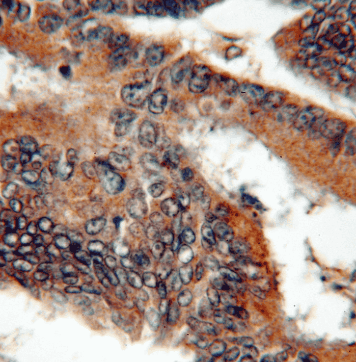 Anti-VEGF antibody - Click Image to Close