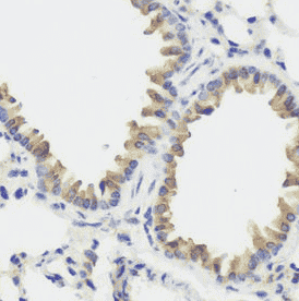 Anti-VEGFR3 antibody - Click Image to Close