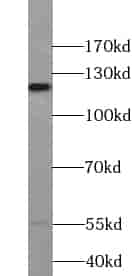 Anti-VEZT antibody - Click Image to Close