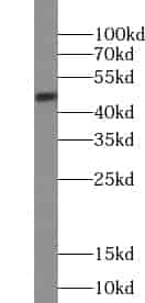 Anti-VPREB3 antibody - Click Image to Close