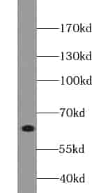 Anti-VPS45 antibody - Click Image to Close