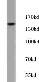Anti-VPS8 antibody - Click Image to Close