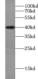 Anti-VSTM1 antibody - Click Image to Close