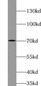 Anti-VSX1 antibody - Click Image to Close