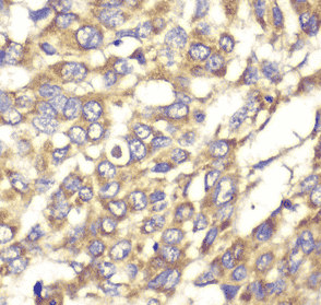 Anti-VTI1B antibody - Click Image to Close